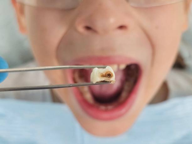 Best Emergency Denture Repair in Coral Terrace, FL